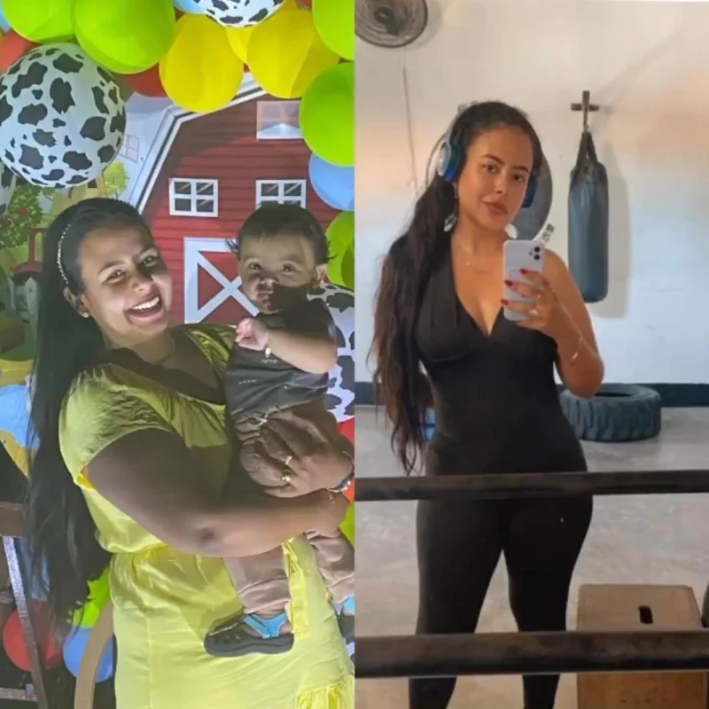 Foto antes e depois real, caso 2