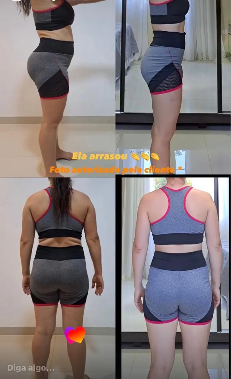 Foto antes e depois real