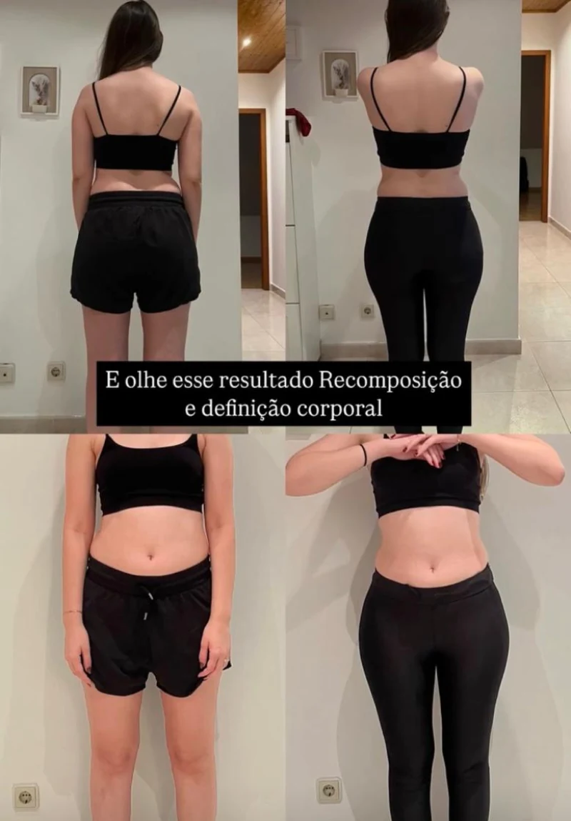 Foto antes e depois real, resultado verificado