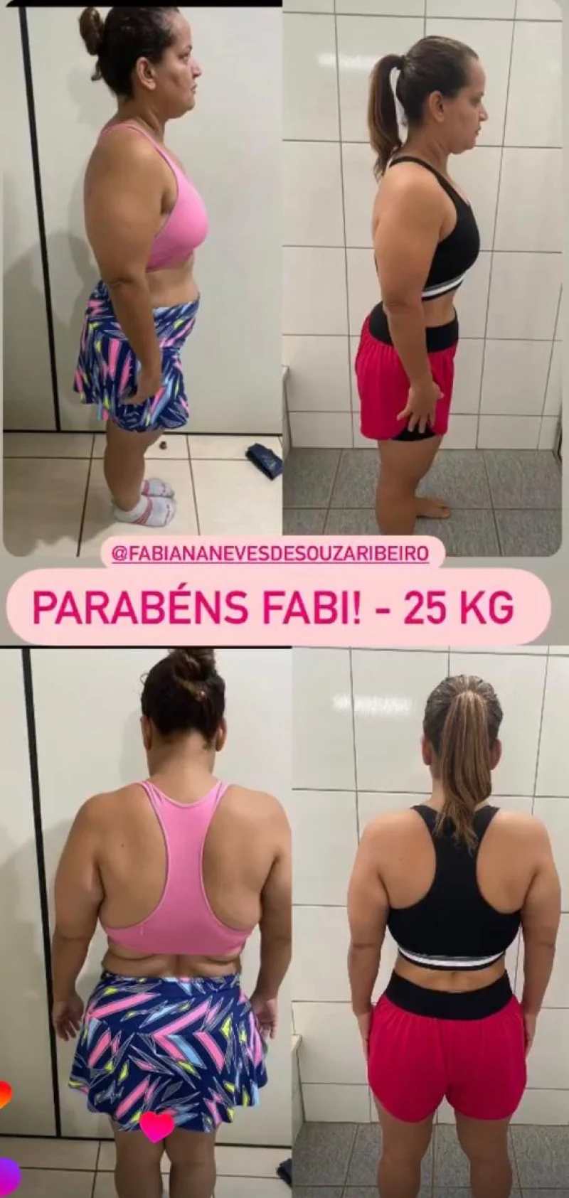 Foto antes e depois real, oferta final, caso 3